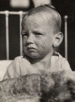 Young Patient, 1935 Young Patient, 1935