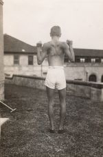 Tuberculous Spine, 1933 Tuberculous Spine, 1933