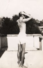 Tuberculous Spine, 1933 Tuberculous Spine, 1933