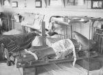 Two Hospital Patients, Circa 1947 Two Hospital Patients, Circa 1947