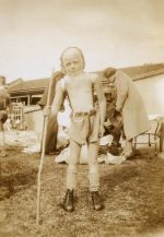 Patient in Orthopaedic Brace, 1943 Patient in Orthopaedic Brace, 1943