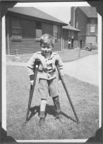 Young Child with Crutches, Circa 1940 Young Child with Crutches, Circa 1940