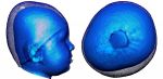 3D comparison image of a patient’s head, 2015